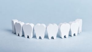 How Bad Overlapping Teeth Can Be And What's The Best Cure