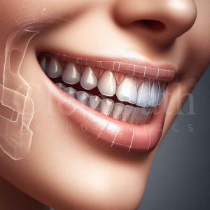 An image of a jaw presenting the perfect teeth alignment.
