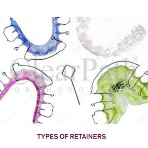 Different types of dental retainers after braces