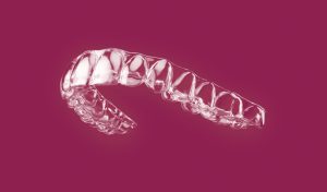 A complete guide eleborating how and why clear aligners might be the best treatment option among all removable alignment treatments.