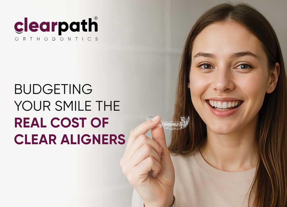 Clear Aligners Expenses