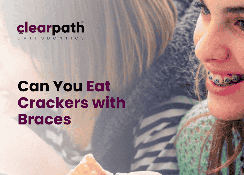 Crisp Can You Eat Crackers With Braces View for Desktop Crisp Can You Eat Crackers With Braces View for Desktop
