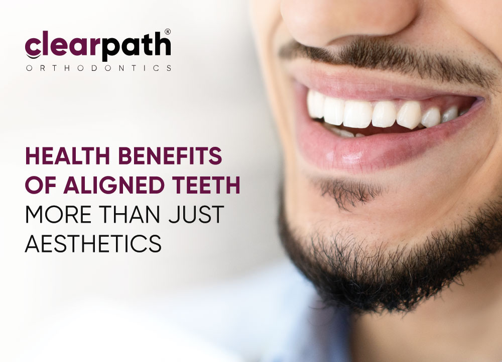 Aligned Teeth Benefit Your Health