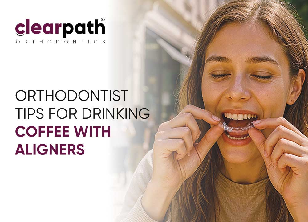 Coffee with Aligners