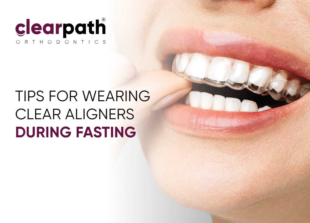 How to Manage Clear Aligners While Fasting