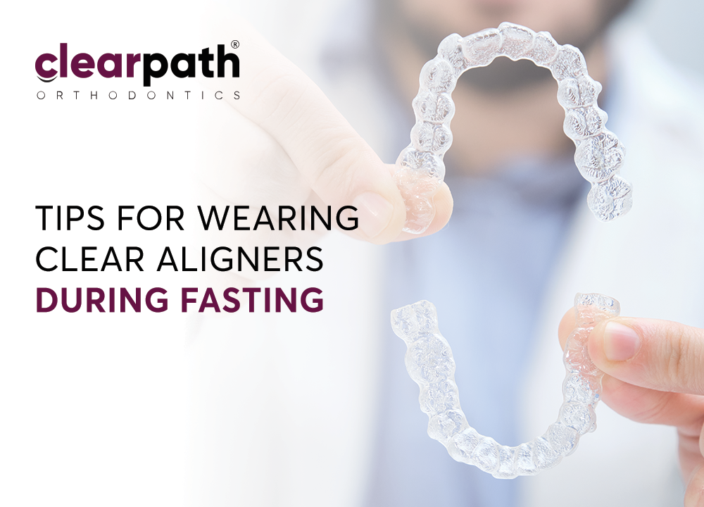 How to Manage Clear Aligners While Fasting