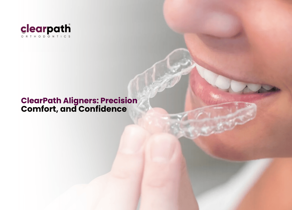Clear Path Line ClearPath Aligners Superior Over Other Aligner Brands in Pakistan