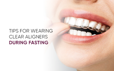 Clear Aligners While Fasting