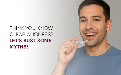 Myths About Clear Aligners