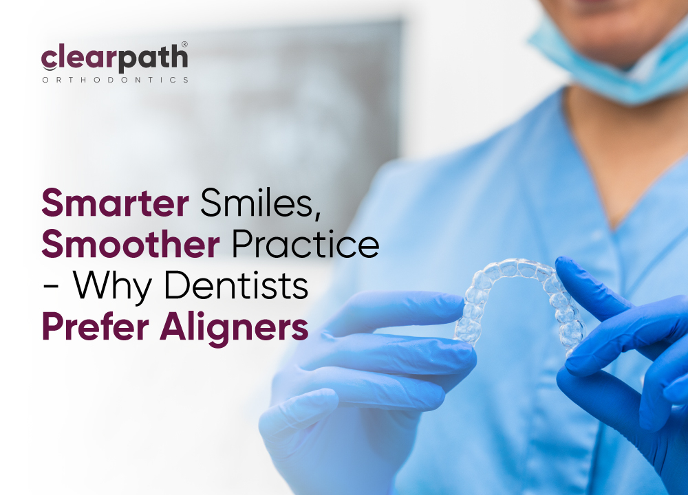 Why Dentists Are Switching to Clear Aligners