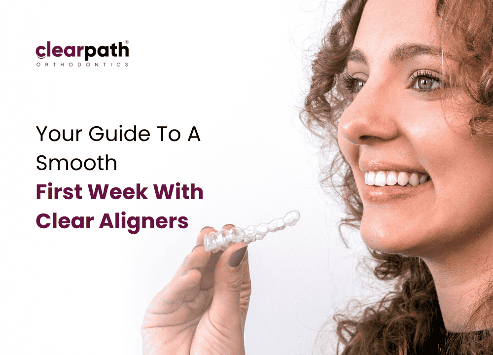 First Week with Clear Aligners