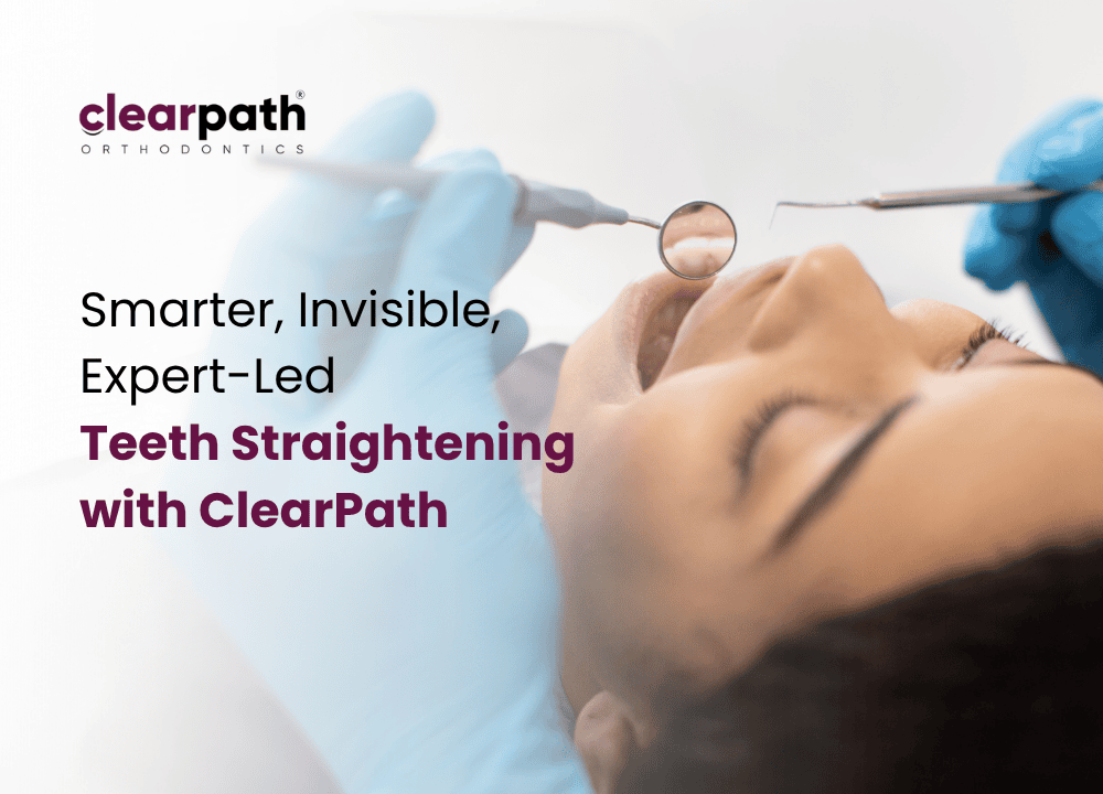 Invisible Aligners for Teeth Straightening