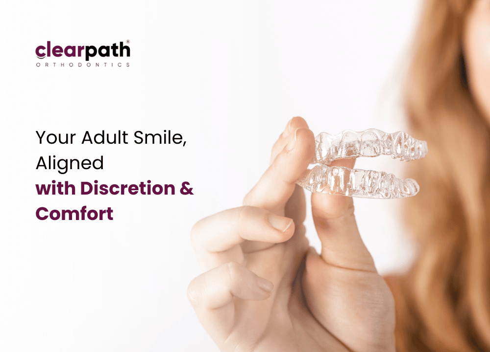 Aligners for Adults