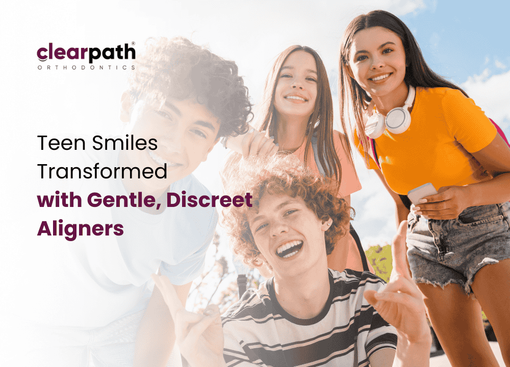 Aligners for Teens