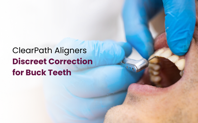 Treating Buck Teeth