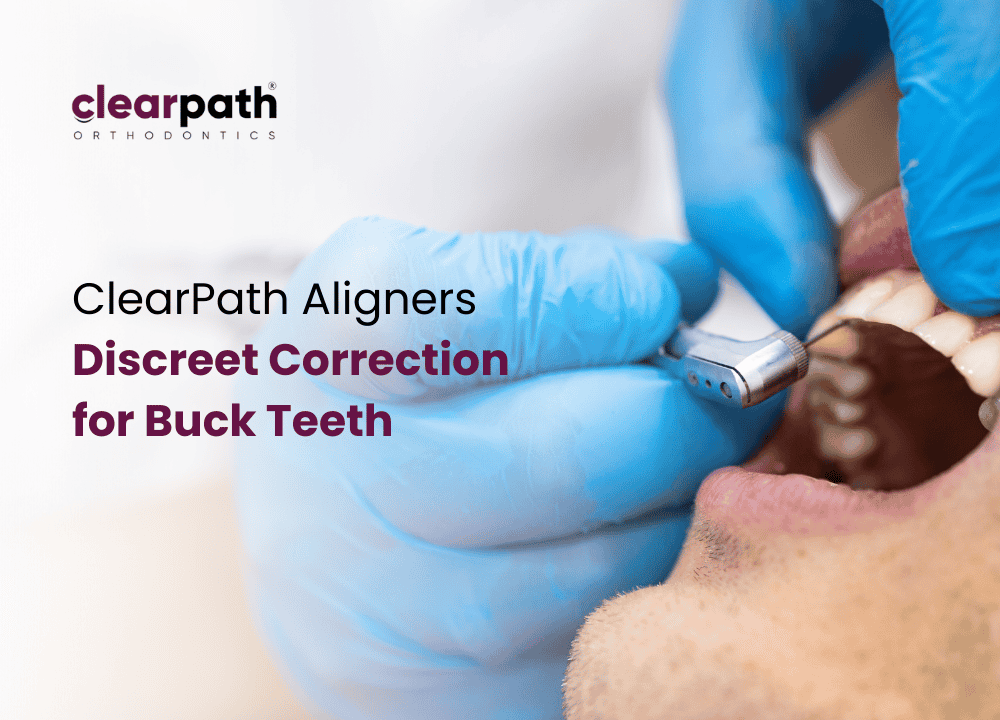 Buck Teeth