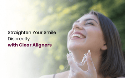 What Are Clear Aligners
