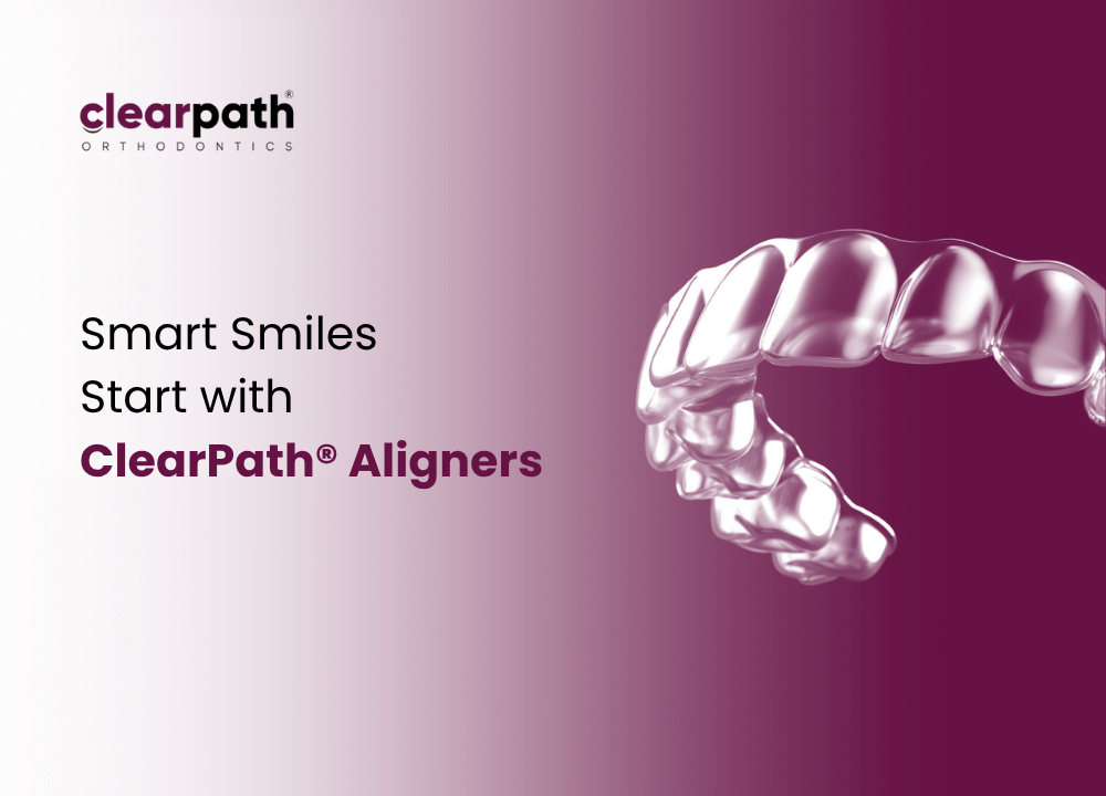 ClearPath Aligners