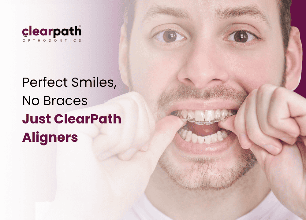 Straightens Teeth Without Braces