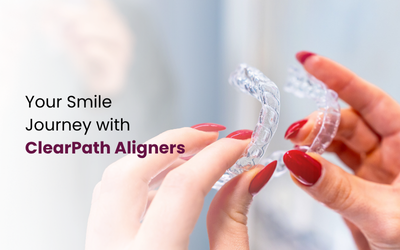 ClearPath Aligners