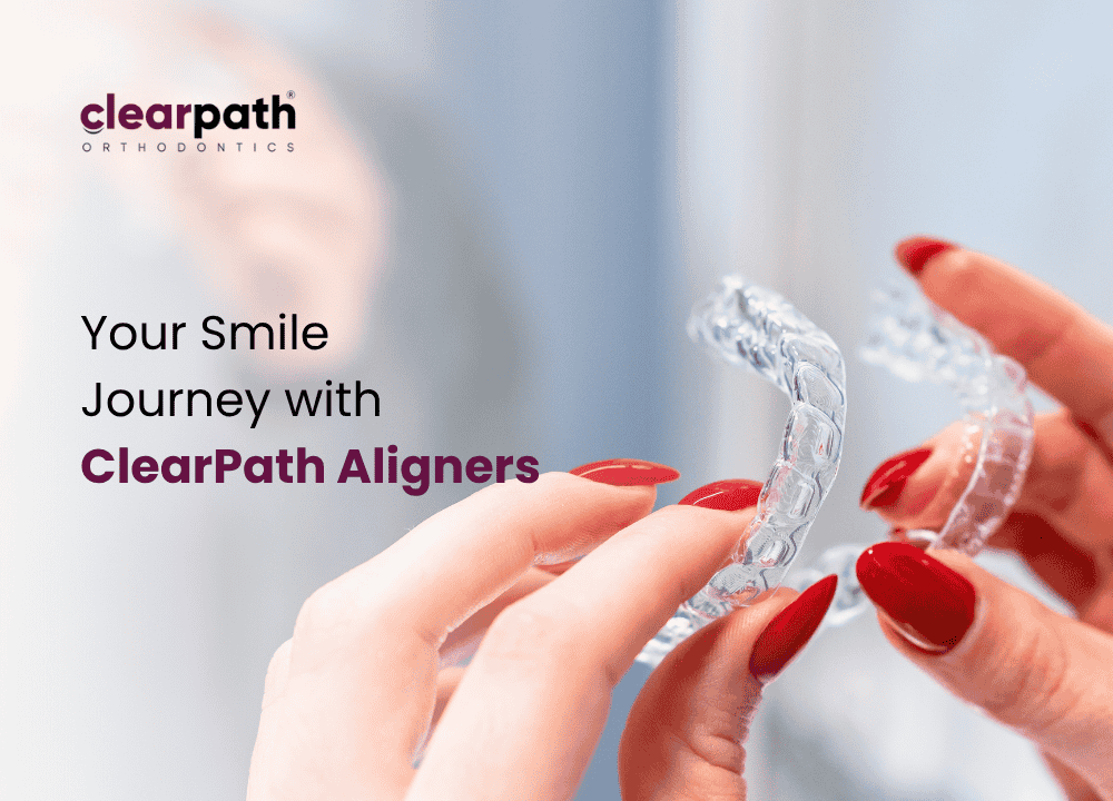 ClearPath Aligners