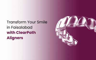 Aligners in Faisalabad
