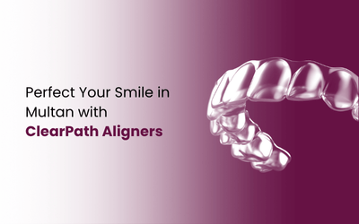 Aligners in Multan