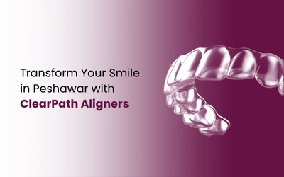 Aligners in Peshawar