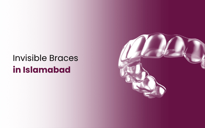 Invisible Braces in Islamabad