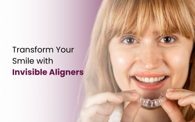 Invisible Aligners