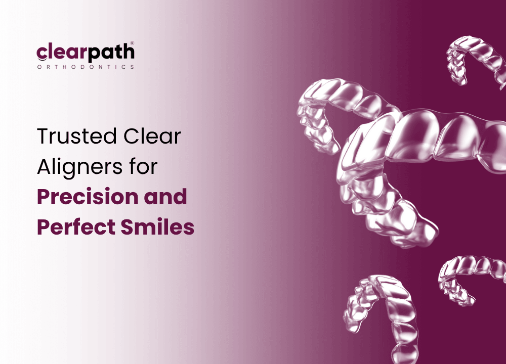 ClearPath Over Other Aligners