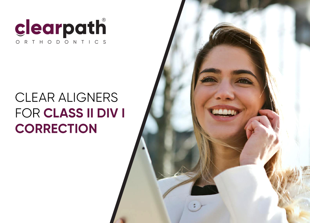 Clear Aligner Therapy: An Innovative Solution for Class II Division I Malocclusion