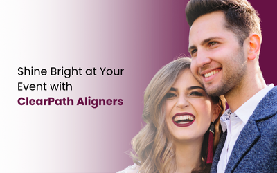 Aligners for Weddings