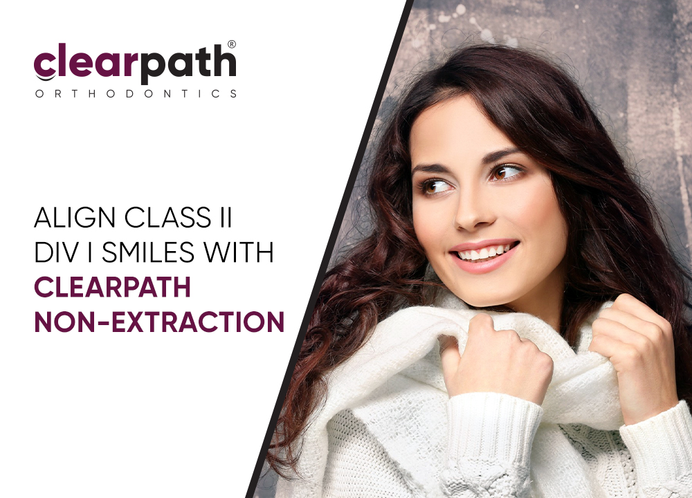 Non-Extraction Correction of Class II Division I Malocclusion with ClearPath Aligners