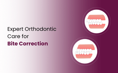 Overbite vs Underbite