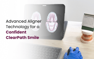 Best Aligner Technology