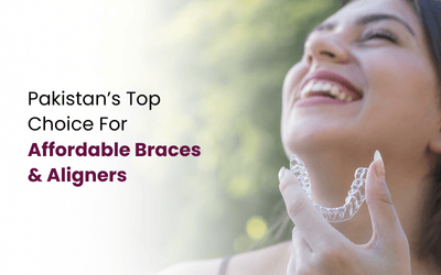 Invisible Braces Prices in Pakistan