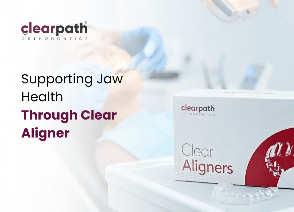 Clear Aligners Relieve Jaw Pain