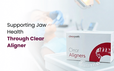 Clear Aligners Relieve Jaw Pain