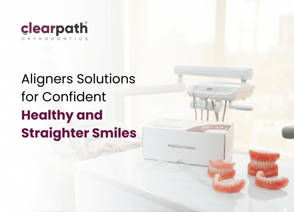 Aligners Solutions