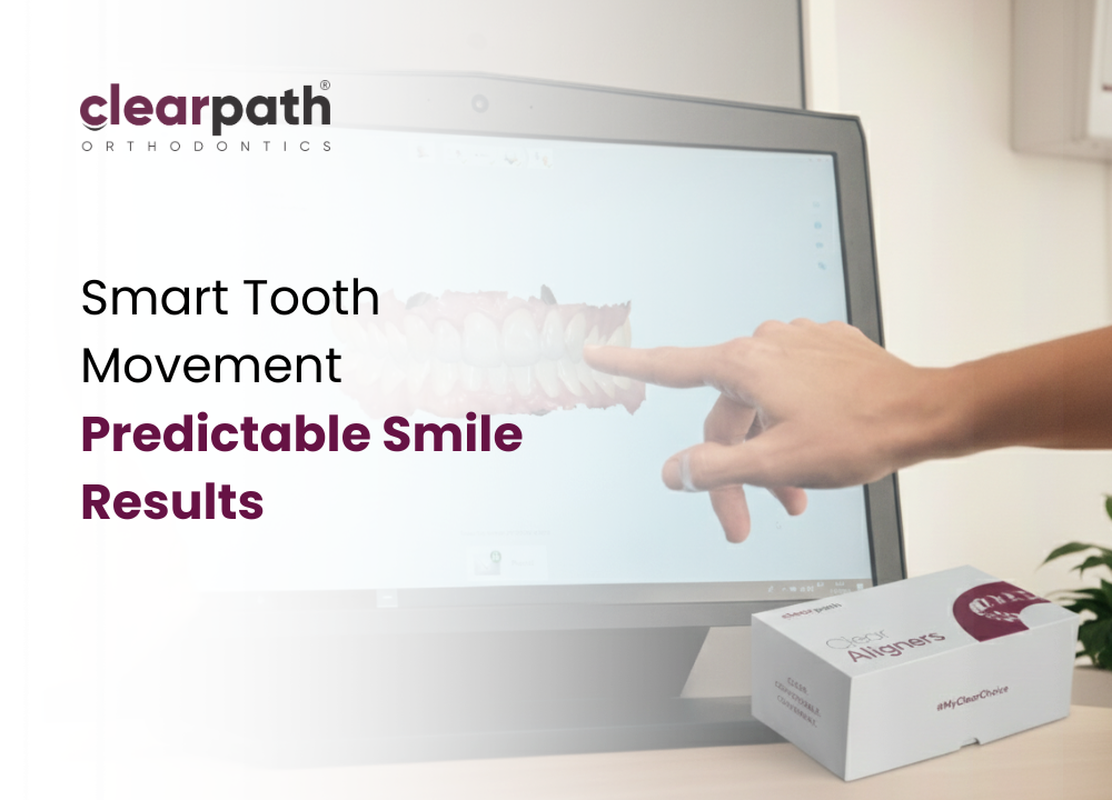 Tooth Movement Process