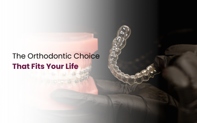 Aligners vs Braces
