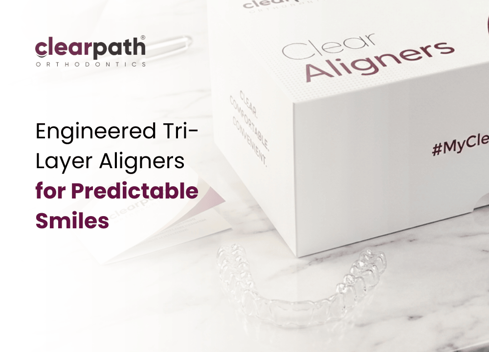 Tri-Layer Aligners