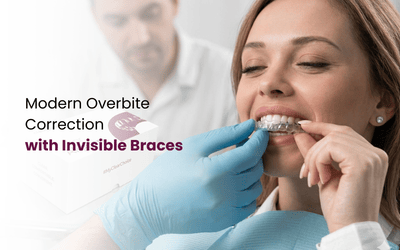 Braces for Overbite