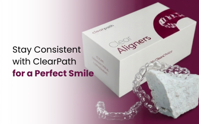 ClearPath aligners
