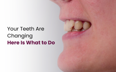 Crooked Teeth