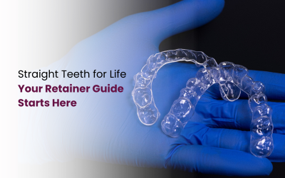 Retainer After Clear Aligner Treatment