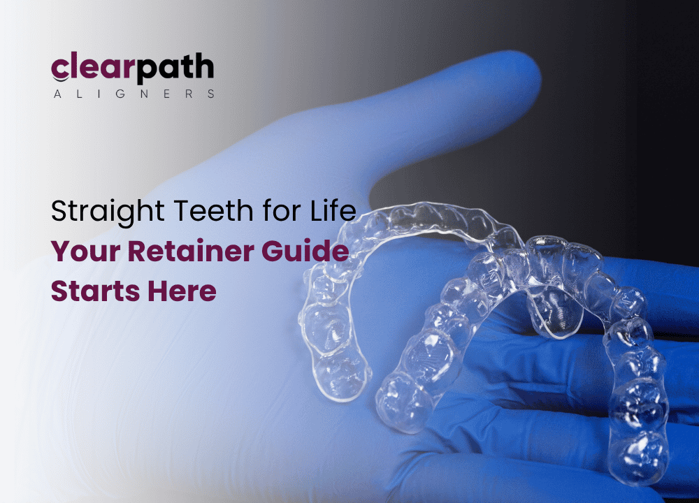 Retainer After Clear Aligner Treatment