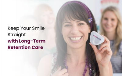 Retainers After Clear Aligners