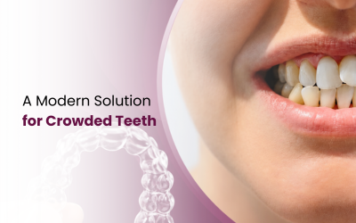 Dental Crowding Teeth